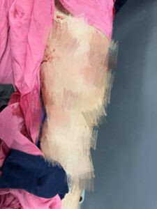 MEITU_٢٠٢٦٠٢٢٠_٢٢٤٩١٣٢٦٩-225x300 مصدر طبي: حالة الطفل المصاب بطلق خرطوش في القليوبية خطيرة وقد تستدعي البتر